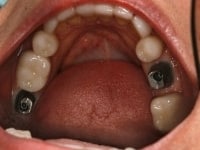 Konig Center for Cosmetic & Comprehensive Dentistry smile photos